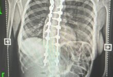 الإنذار-شمل-5-محافظات.-ضباب-وتدني-في-الرؤية-على-أجزاء-من-الشرقية