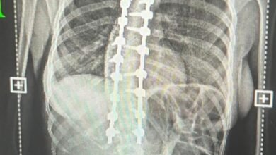 الإنذار-شمل-5-محافظات.-ضباب-وتدني-في-الرؤية-على-أجزاء-من-الشرقية