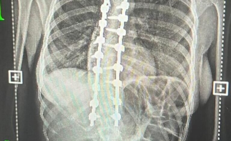 الإنذار-شمل-5-محافظات.-ضباب-وتدني-في-الرؤية-على-أجزاء-من-الشرقية
