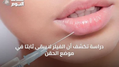 دراسة-تكشف-أن-الفيلر-لا-يبقى-ثابتًا-في-موضع-الحقن