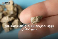 روبوت-بحجم-حبة-الأرز-يفتح-آفاقاً-جديدة-لعلاج-حصوات-الكلى