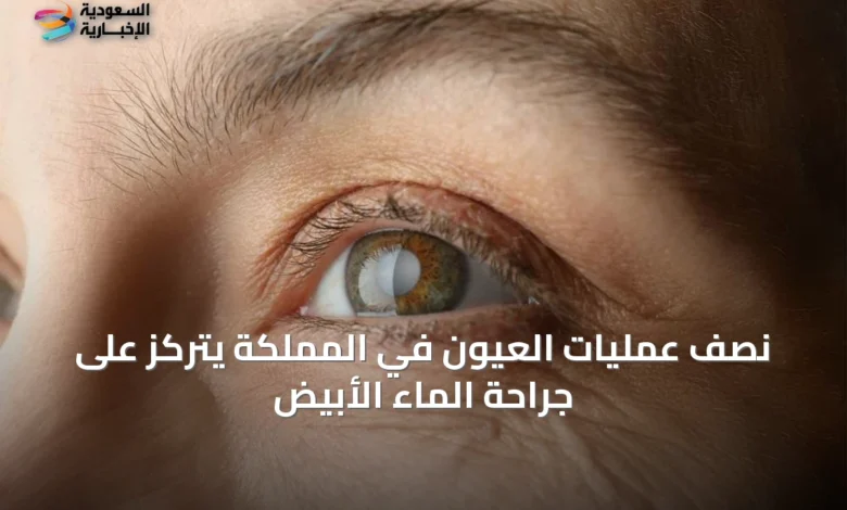 نصف-عمليات-العيون-في-المملكة-يتركّز-على-جراحة-الماء-الأبيض